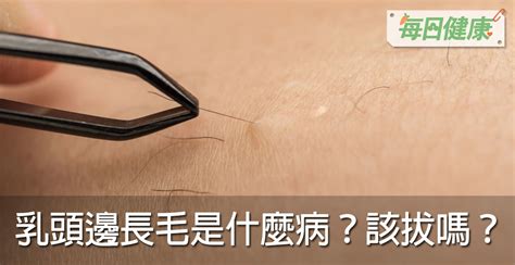 奶頭上長毛|乳頭邊長了毛，是什麼病？該不該拔？讓名醫一次解釋給您聽｜每